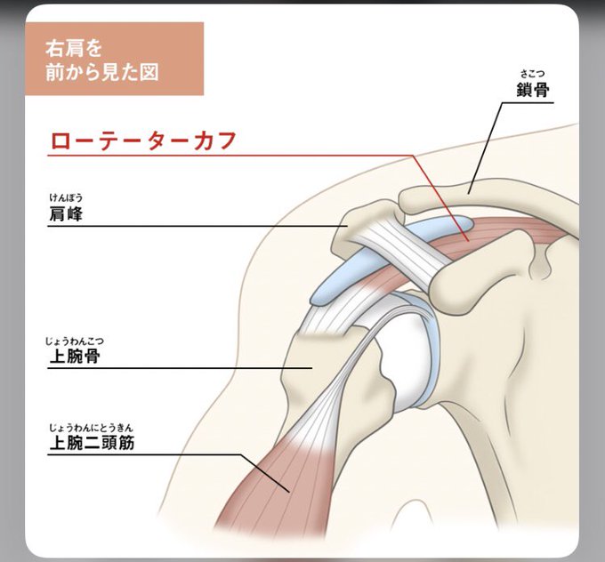 インピンジメント症候群の画像